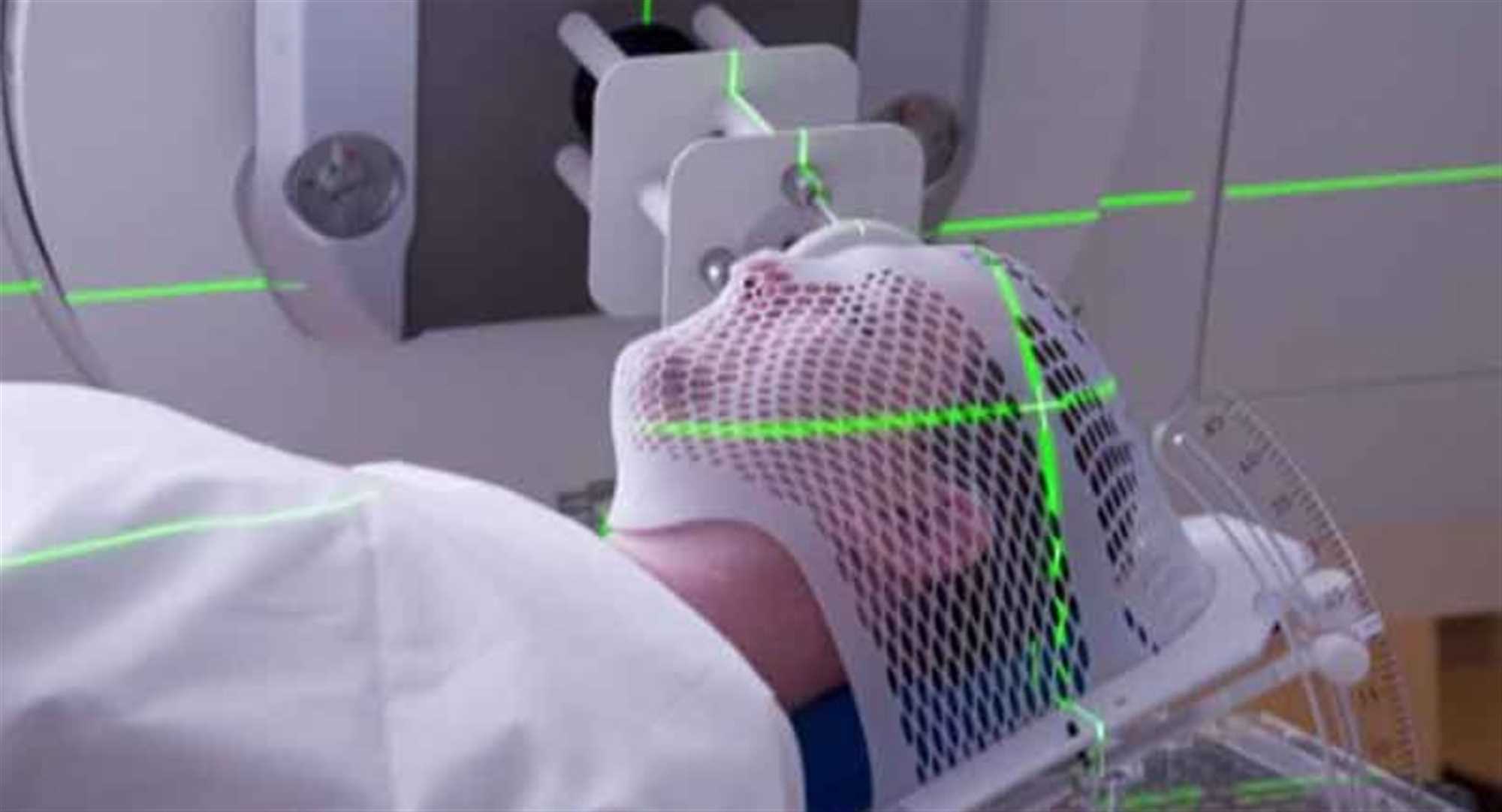 پرتو درمانی