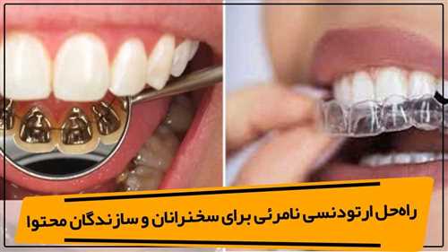 ارتودنسی نامرئی